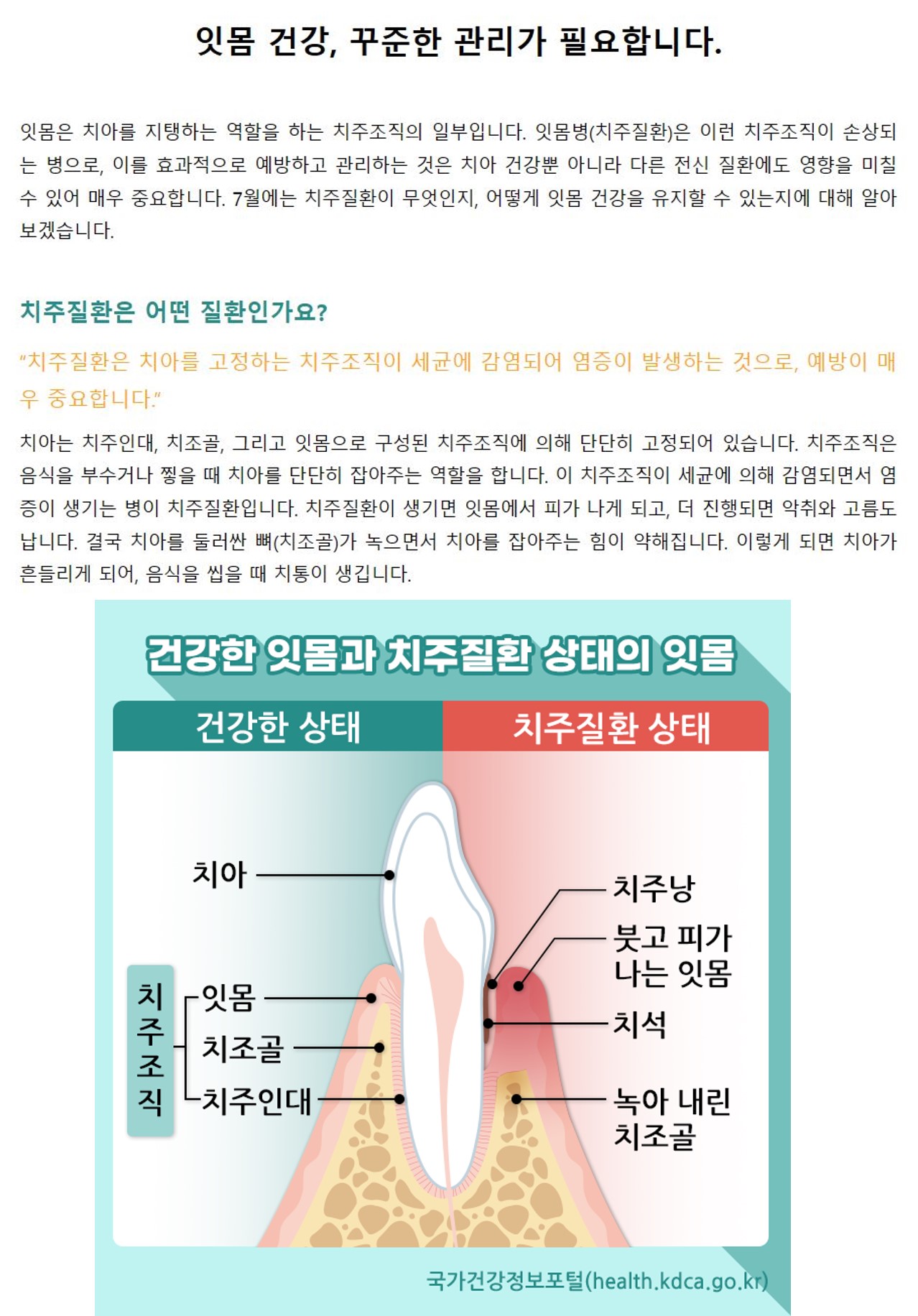 [스마일 구강]잇몸 건강, 꾸준한 관리가 필요합니다. 1