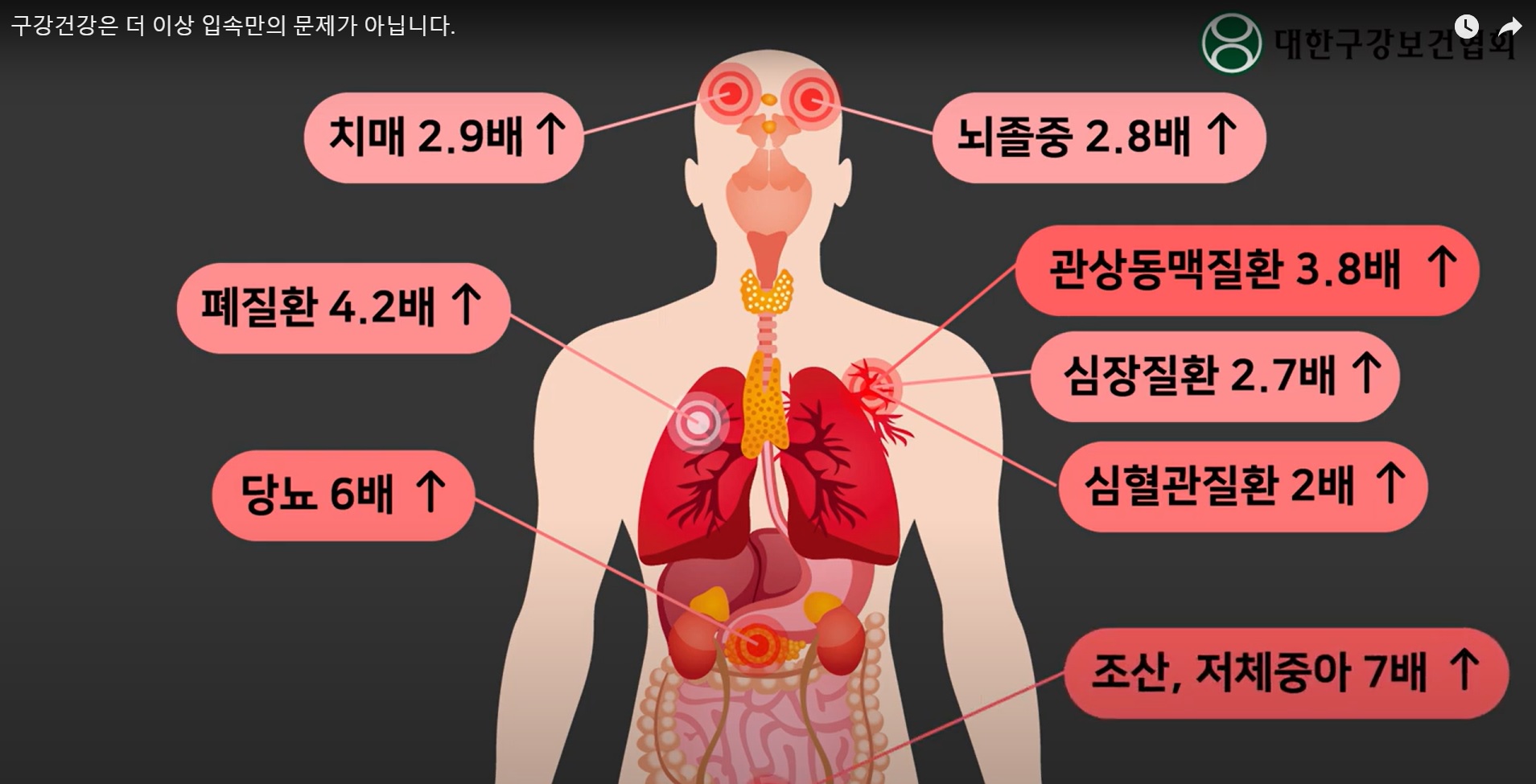 [스마일 구강]구강건강은 더 이상 입속만의 문제가 아닙니다. 1