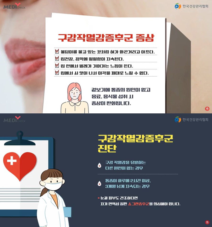 [스마일 구강]구강작열감증후군 갱년기 여성에게 흔합니다. 2