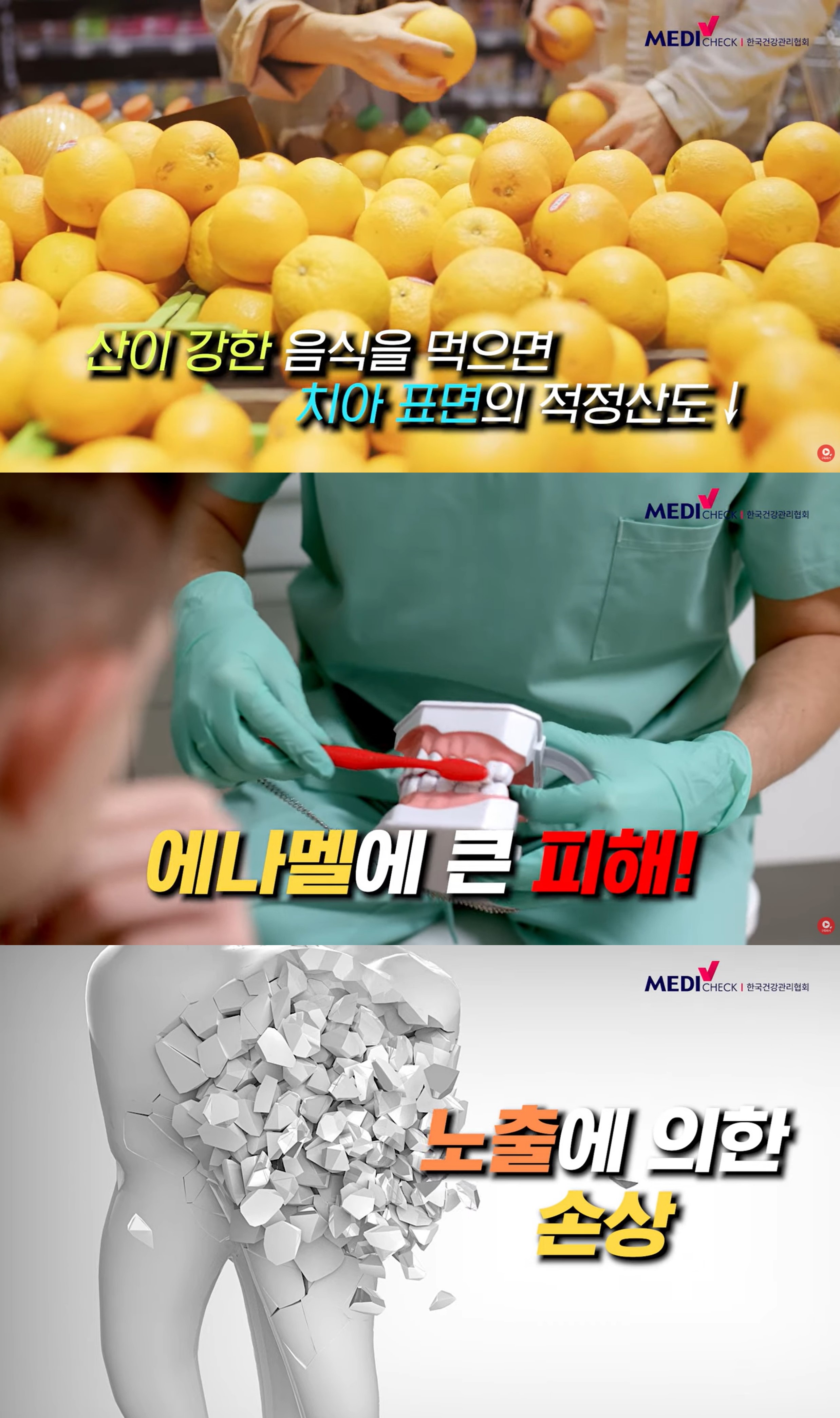 [스마일 구강]식후 하는 양치가 안 좋을 때도 있다?! 3
